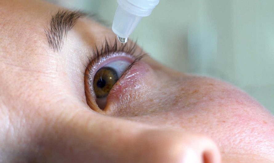 Beyond the Blink: Unveiling Effective Solutions for Dry Eye